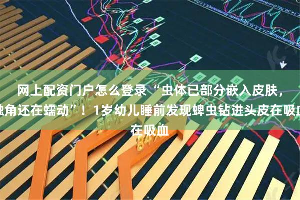 网上配资门户怎么登录 “虫体已部分嵌入皮肤，触角还在蠕动”！1岁幼儿睡前发现蜱虫钻进头皮在吸血